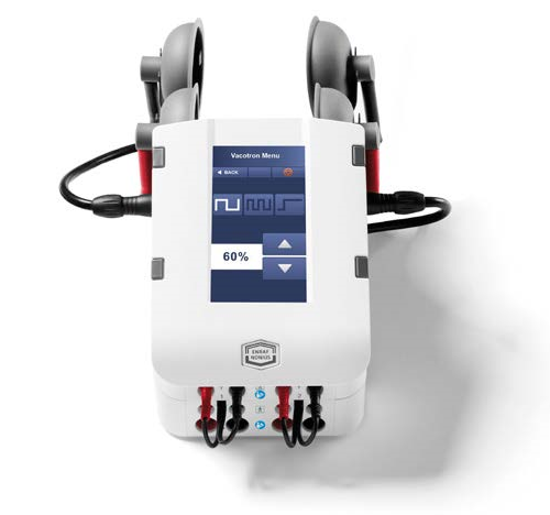 Interferential Therapy